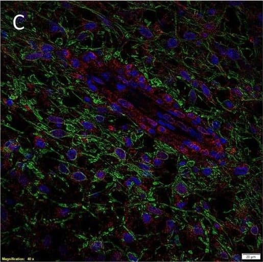 Immunocytochemistry/ Immunofluorescence AGTR-2 Antibody - BSA Free