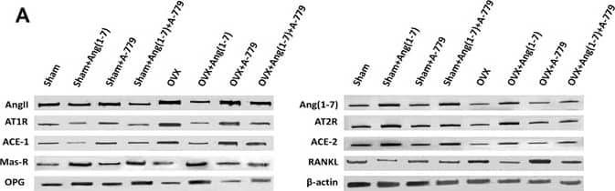 Western Blot: AGTR-2 Antibody - BSA Free [NBP1-77368] - Effects of Ang(1-7) and/or A-779 treatments to the sham & OVX animals for 6 weeks on the expressions of RAS different proteins & osteoclastogenesis modulating factors in the femoral bone heads. (A) Western blot analysis bands showing the expressions of AngII, Ang(1-7), AT1R, AT2R, ACE, ACE-2, MasR, RANKL & OPG. (B) Quantification of the scanning densitometry of the western blot bands (n = 8/group) expressed as arbitrary units. One-way ANOVA test followed by post hoc Student-Newman-Keuls multiple comparisons test were used for the statistical analysis. Columns & bars represent the mean ± SEM of each group. Statistical significance was considered when *P < 0.05 & **P < 0.01 as compared to Sham group & #P < 0.05 & ##P < 0.01 as compared to OVX group. Image collected & cropped by CiteAb from the following publication (//www.nature.com/articles/s41598-017-02570-x), licensed under a CC-BY license. Not internally tested by Novus Biologicals.