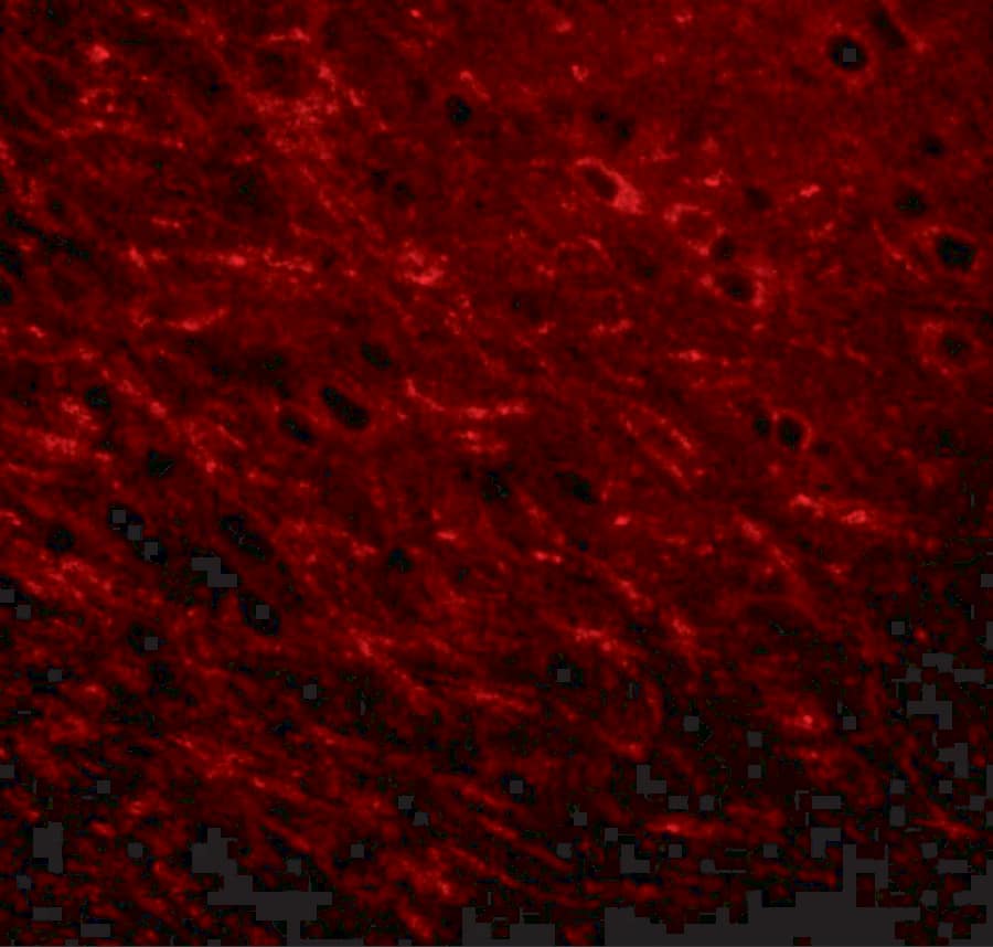 Immunocytochemistry/ Immunofluorescence ProSAPiP1 Antibody - BSA Free