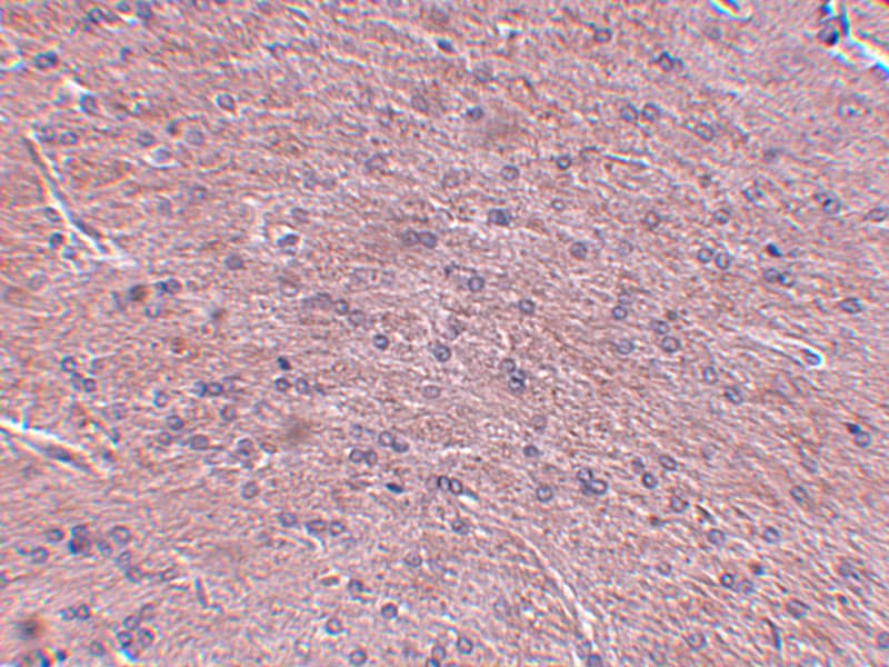 Immunohistochemistry ProSAPiP1 Antibody - BSA Free