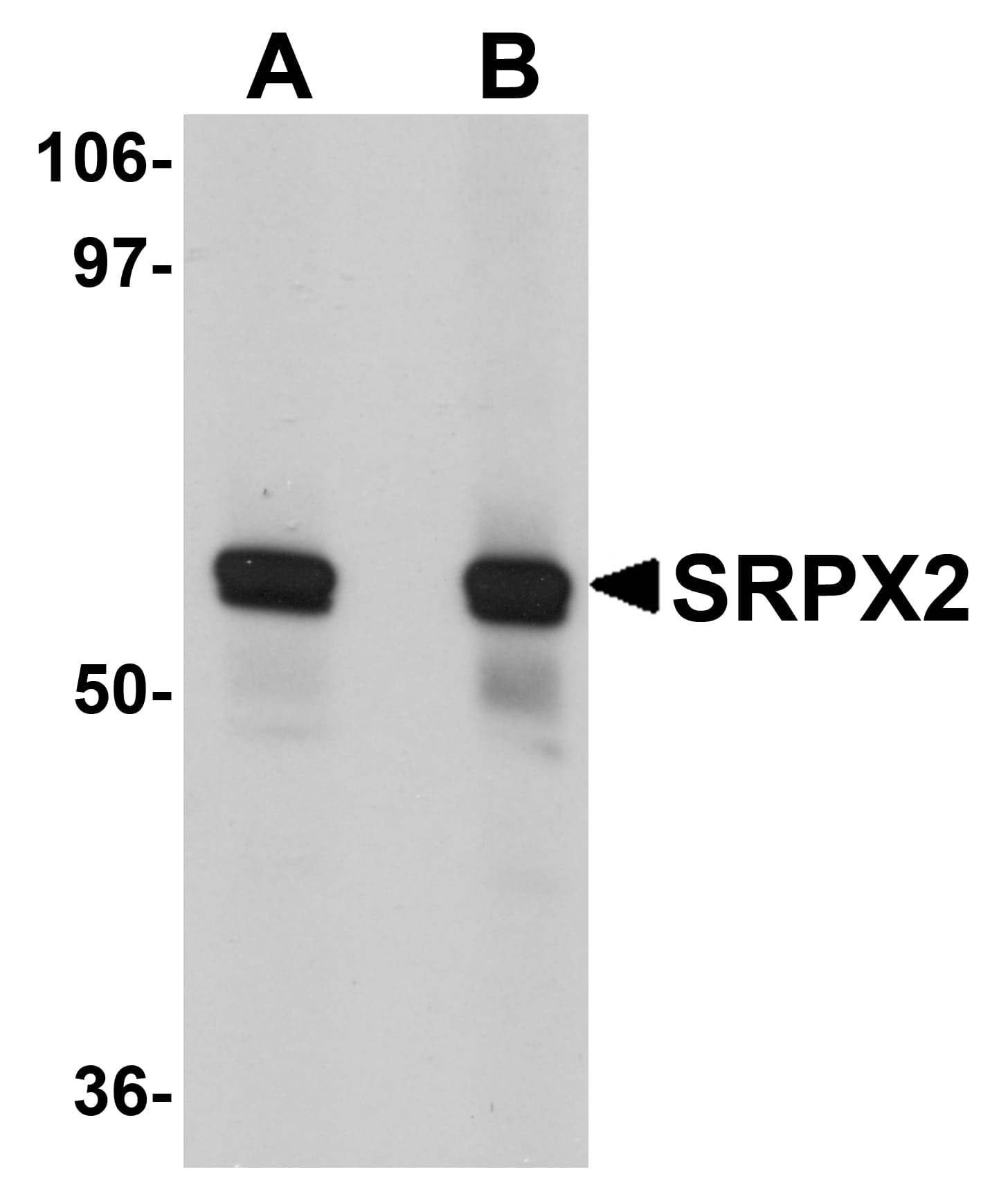 Western Blot: SRPX2 Antibody - BSA Free [NBP1-77370] - Western blot analysis of SRPX2 in human lung tissue lysate with SRPX2 antibody at (A) 1 and (B) 2 u/mL.