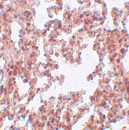 Immunohistochemistry SRPX2 Antibody - BSA Free