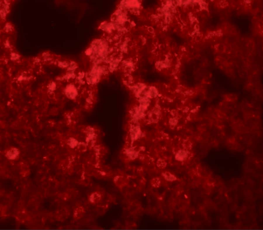 Immunocytochemistry/ Immunofluorescence: SRPX2 Antibody - BSA Free [NBP1-77370] - Immunofluorescence of SRPX2 in human lung tissue with SRPX2 antibody at 20 u/mL.