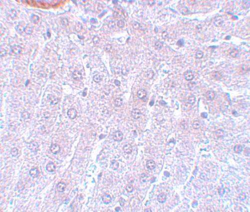 Immunohistochemistry: Cdc27 Antibody - BSA Free [NBP1-77377] - Immunohistochemistry of Cdc27 in rat liver tissue with Cdc27 antibody at 5 ug/mL.