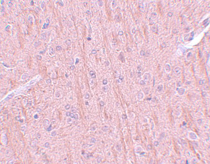 Immunohistochemistry: CCDC106 Antibody - BSA Free [NBP1-77381] - Immunohistochemistry of CCDC106 in rat brain tissue with CCDC106 antibody at 5 ug/mL.