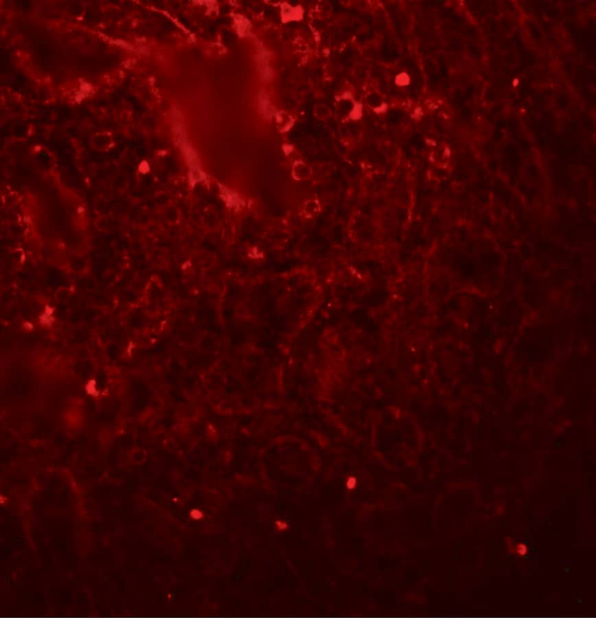 Immunocytochemistry/ Immunofluorescence: LIN-28A Antibody - BSA Free [NBP1-77383] - Immunofluorescence of LIN28 in human spleen tissue with LIN28 antibody at 20 ug/mL.