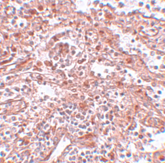 Immunohistochemistry: LIN-28A Antibody - BSA Free [NBP1-77383] - Immunohistochemistry of KLF4 in human spleen tissue with KLF4 antibody at 5 u/mL.