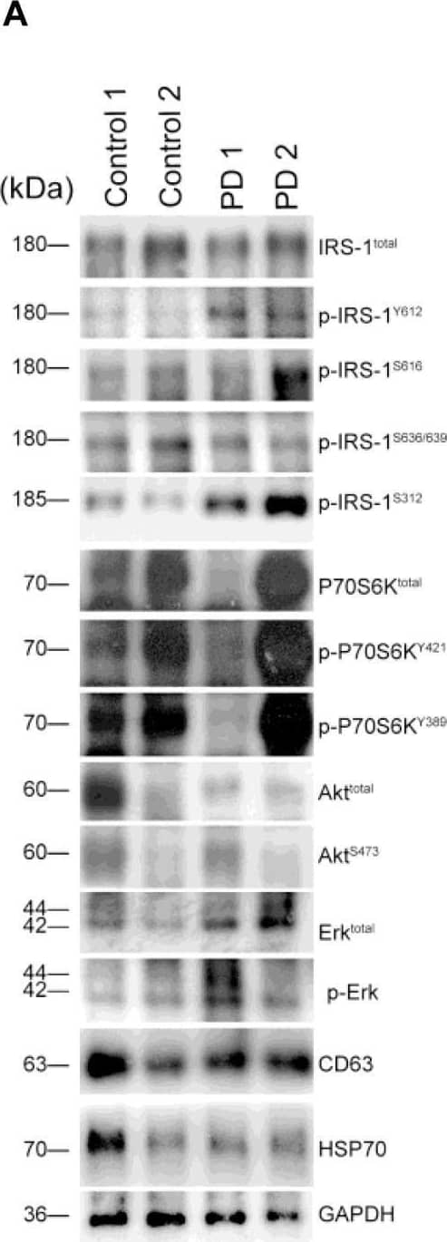 Total IRS-1, p-IRS-1 and downstream substrates level in blood neuron-derived extracellular vesicles. (A) The representative protein blot images of IRS-1 and different phosphorylated forms of IRS-1, including Y612, S616, S636/639, and S312. HSP70 and CD63 were exosomal proteins and markers. GAPDH was the protein loading control (1 and 2 indicate different samples). Comparison of the levels of total IRS-1, p-IRS-1Y612, p-IRS-1S616, p-IRS-1S636/639, p-IRS-1S312(B), and downstream IRS-1 substrates (C–E) between healthy controls [with or without diabetes mellitus (DM)] and Parkinson’s disease (PD) patients (with or without DM). The phosphorylation status of IRS-1, P70S6K, Akt, and Erk was normalized to total form IRS-1, P70S6K, Akt, and Erk. (F) The EV markers–CD63 and HSP70 was not different between 4 groups. Data was presented as mean +/- SEM. *p < 0.05. Image collected and cropped by CiteAb from the following open publication (//pubmed.ncbi.nlm.nih.gov/33344443), licensed under a CC-BY license. Not internally tested by Novus Biologicals.