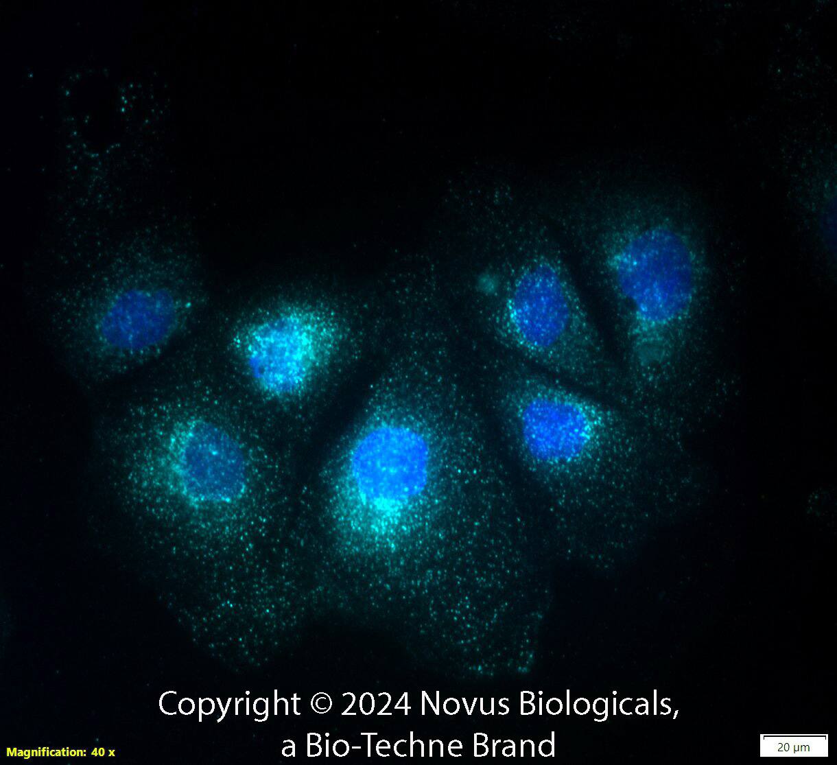 A20/TNFAIP3 (59A426) was detected in immersion fixed Caco-2 human colorectal adenocarcinoma cell line using Mouse anti-A20/TNFAIP3 (59A426) Protein G Purified Monoclonal Antibody conjugated to Alexa Fluor® 647 (Catalog # NBP1-77533AF647) (light blue) at 10 µg/mL overnight at 4C. Cells were counterstained with DAPI (dark blue). Cells were imaged using a 40X objective.