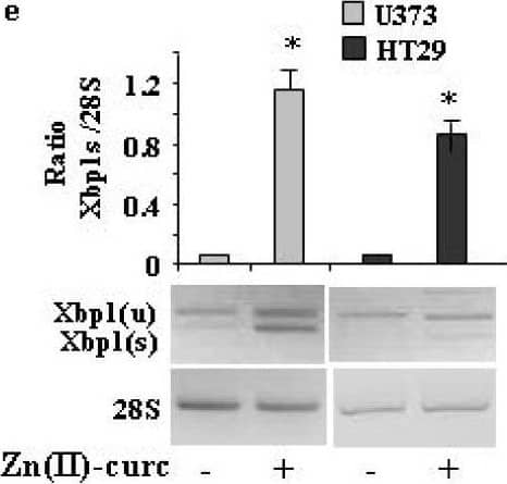 Zn (II)-curc induces endoplasmic reticulum (ER) stress in mutant p53H273-carrying cells. (a) Representative photomicrographs of ER-Red Fluorescence staining in U373 cells untreated (Mock) or treated with Zn (II)-curc (100 ug/mL) for 16 h (Original magnification: 40×). (b) Quantization of ER content in U373 cells from ER-Red Fluorescence-stained cells. Mean fluorescence intensity (MFI) of each individual cell was normalized to cell size and expressed as fold-change compared with untreated cells at the same time point. Histograms represent the mean +/- SD of three independent experiments. * p ≤ 0.05. (c) Western blot analysis of p53, BiP, total (tot) IRE1 alpha , phosphorylated (p) IRE1 alpha , and XBP1 spliced (s) protein levels evaluated in U373 and HT29 cells untreated or treated with Zn (II)-curc (100 ug/mL) for 24 h. (d) Densitometric analysis was performed using Image J software to calculate the ratio of the protein levels, as detected in (c), vs.  beta -actin. Histograms represent the mean +/- SD of three independent experiments. * p ≤ 0.05. (e) Total mRNA was extracted from U373 and HT29 cells untreated or treated with Zn (II)-curc (100 ug/mL) for 24 h. Spliced (s) Xbp1 gene expression was assayed by the polymerase chain reaction (PCR) of reverse-transcribed cDNA. Densitometric analysis was performed using Image J software to calculate the Xbp1s/28S ratio. Histograms represent the mean +/- SD of three independent experiments. * p ≤ 0.05. (f) p53 gene expression was assayed by PCR as in (e). The p53/28S ratio is indicated. Image collected and cropped by CiteAb from the following open publication (//pubmed.ncbi.nlm.nih.gov/32138264), licensed under a CC-BY license. Not internally tested by Novus Biologicals.