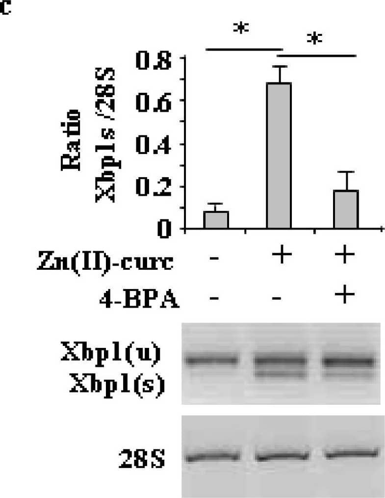 ER stress inhibition impairs Zn (II)-curc-induced autophagy and mutp53 degradation. (a) Western blot analysis of BiP, LC3I/II, and p53 protein levels in U373 cells untreated or treated with Zn(II)-curc (100 ug/mL) for 24 h, with or without 1 h pre-treatment with 4-BPA (2.5 mM). (b) Densitometric analysis was performed using Image J software to calculate the ratio of the protein levels, as detected in (a), vs.  beta -actin. Histograms represent the mean +/- SD of three independent experiments. * p ≤ 0.05. (c) Total mRNA was extracted from U373 cells untreated or treated as in (a). Spliced (s) and unspliced (u) Xbp1 gene expression were assayed by the PCR of reverse-transcribed cDNA. Densitometric analysis was performed using Image J software to calculate the Xbp1s/28S ratio. Histograms represent the mean +/- SD of three independent experiments. * p ≤ 0.05. Image collected and cropped by CiteAb from the following open publication (//pubmed.ncbi.nlm.nih.gov/32138264), licensed under a CC-BY license. Not internally tested by Novus Biologicals.