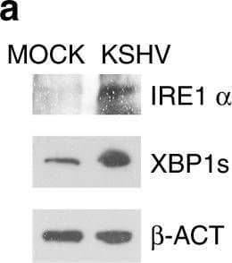 KSHV activates UPR and up-regulates PD-L1 on KSHV- infected macrophages.a Ire1 alpha  and XBP1s expression in mock- and KSHV-infected macrophages was evaluated by western blot analysis; b ATF4, CHOP and BIP expression in mock- and KSHV-infected macrophages was evaluated by western blot analysis.  beta -actin ( beta -ACT) was used as loading control. A representative experiment out of three is shown. Histograms represent the mean plus S.D. of the densitometric analysis of the ratio of each protein/ beta -ACT. *p-value < 0.05. c PD-L1 expression on mock- and KSHV-infected macrophages was evaluated by FACS analysis. A representative experiment is shown, and the mean of fluorescence intensity is indicated. Grey peaks represent the isotype controls. d Histograms representing the mean plus SD of PD-L1 MFI (Mean fluorescence Intensity) are also reported. *p-value < 0.05. Image collected and cropped by CiteAb from the following open publication (//pubmed.ncbi.nlm.nih.gov/32418990), licensed under a CC-BY license. Not internally tested by Novus Biologicals.