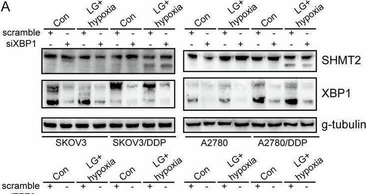 Selective utilization of SHMT2 promoter 2 by HIF1 alpha  and TFE3 complex.A, B Western blot analysis of SHMT2, SHMT2 alpha , XBP1, TFE3, HIF1 alpha  protein expression upon XBP1, TFE3, HIF1 alpha  knockdown respectively in cisplatin-sensitive (parental) and cisplatin-resistant (DDP) SKOV3 or A2780 cells under different cell culture. C Luciferase assay different promoter activity upon XBP1, TFE3, HIF1 alpha  knockdown respectively cisplatin-resistant (DDP) SKOV3 or A2780 cells under low-glucose and hypoxic environment. D Co-IP experiment testing the interaction between TFE3, HIF1 alpha  in cisplatin-resistant (DDP) SKOV3 or A2780 cells under low-glucose and hypoxic environment. E Binding pose of TFE3 with HIF1 alpha  in 3D. F, G PLA analyze showing the distribution of TFE3 with HIF1 alpha  in cisplatin-resistant (DDP) SKOV3 or A2780 cells under different cell culture. Image collected and cropped by CiteAb from the following open publication (//pubmed.ncbi.nlm.nih.gov/40097394), licensed under a CC-BY license. Not internally tested by Novus Biologicals.