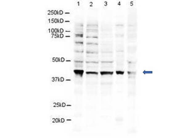 Western blot using Affinity Purified anti-RING1B antibody shows detection of a 38 kDa band corresponding to human RING1B. Lane 1: 3T3 whole cell lysates 