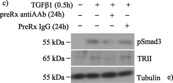 Activin A facilitates TGF beta 1-induced type II receptor expression without altering TGF beta 1 receptor sensitivity in MC. a TGF beta 1 for 30 min increased TRII expression and Smad3 activation in whole cell lysate, and both were prevented by 24 h pretreatment with follistatin (n = 6). b There was no change in TRII transcript after 24 h of follistatin with or without TGF beta 1 for 30 min. c Pretreatment with an actA neutralizing antibody for 24 h inhibited acute (30 min) TGF beta 1-induced Smad3 activation and TRII upregulation (n = 6–7). These were similarly inhibited by downregulation of the actA type I receptor ALK4 with siRNA (d) (n = 3). e Pretreatment with actA (20 ng/ml) for 24 h did not affect acute TGF beta 1-induced Smad3 activation (n = 6). *, **, ****P < 0.05, 0.01, 0.0001; one-way ANOVA with Tukey’s multiple comparisons post hoc test Image collected and cropped by CiteAb from the following open publication (//pubmed.ncbi.nlm.nih.gov/36717814), licensed under a CC-BY license. Not internally tested by Novus Biologicals.