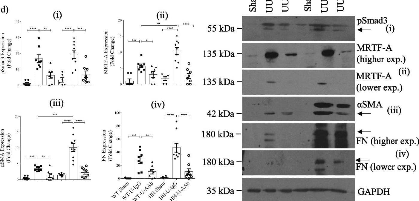 Immunocytochemistry/Immunofluorescence: Smad3 [p Ser423, p Ser425] Antibody [NBP1-77836] - BH4 precursor, sepiapterin, normalizes NO level and ameliorates malignant phenotype of precancerous and cancerous cells. Representative images of the progression series cultivated in 3D ECM with or without sepiapterin (20 uM) and stained for phospho-SMAD3 or ERBB2. Nuclei were counterstained with DAPI (blue). Scale bars: 20 um. (Bottom) Quantification of phospho-SMAD3 (left) and ERBB2 levels (right) of the progression series. Error bars: mean +/- STDEV. *p  2 groups; t-test for 2 groups Image collected and cropped by CiteAb from the following open publication (//pubmed.ncbi.nlm.nih.gov/36717814), licensed under a CC-BY license. Not internally tested by Novus Biologicals.