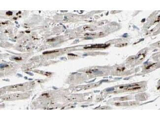  Affinity Purified anti-iASPP antibody shows strong cytoplasmic and membranous staining of myocytes in human heart tissue. Tissue was formalin-fixed and paraffin embedded. Brown color indicates presence of protein, blue color shows cell nuclei.  Personal Communication, Kenneth Wester, www.proteinatlas.org, Uppsala, Sweden.