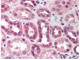  Anti-CUL5 antibody was diluted 1:500 to detect CUL5 in human kidney tissue. Tissue was formalin fixed and paraffin embedded. No pre-treatment of sample was required. The image shows the localization of antibody as the precipitated red signal, with a hematoxylin purple nuclear counter stain.