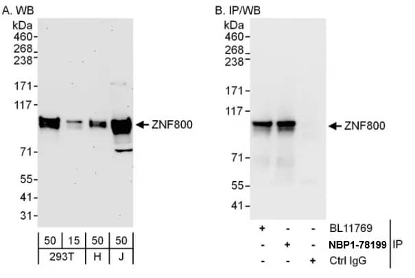 Western Blot ZNF800 Antibody