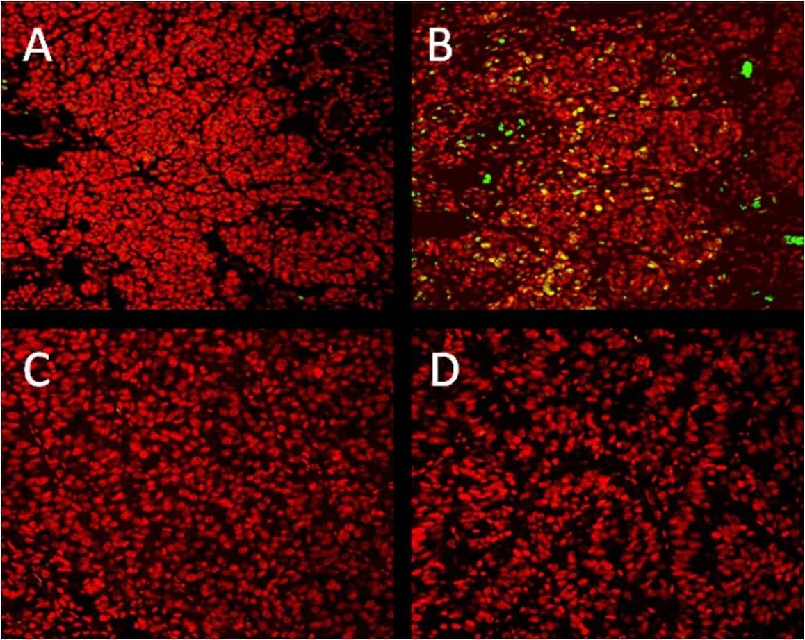 Immunocytochemistry/ Immunofluorescence: GLI-1 Antibody - BSA Free [NBP1-78259] - In vivo GLI1 expression after intratumoral administration of NVP-LDE225.LOX OMVI human melanoma cells were injected s.c into both flanks as mentioned above. Tumors were treated intratumorally on daily basis with vehicle (A & B) or NVP-LDE225 (C & D). Immunofluorescent microscopy of GLI1was performed on isolated tumor tissues. GLI1 staining was performed by overnight incubation of sections at 4°C with rabbit anti-human polyclonal Ab (B & D, NBP1-78259, Novus Biologicals, Littleton, CO) or isotype control (A & C) followed by an 1 hr-incubation with Alexa Fluor® 488 Donkey IgG, anti-rabbit (A21206, Invitrogen, Carlsbad, CA) at RT (green). Counterstaining of nuclei was performed with propidium iodide (red). Pictures were taken on a confocal laser-scanning microscope system (LSM 410; Zeiss). Yellow color corresponds to double positive (anti-GLI1 & propidium iodide) nuclear staining. Image collected & cropped by CiteAb from the following publication (//pubmed.ncbi.nlm.nih.gov/23935925), licensed under a CC-BY license. Not internally tested by Novus Biologicals.