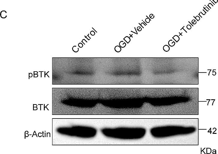 Western Blot BTK [p Tyr223] Antibody - BSA Free