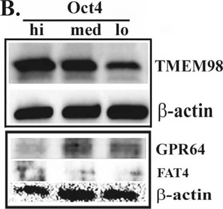 Western Blot: FAT4 Antibody - BSA Free [NBP1-78381] - Expression of selected genes in BCC subsets. (A) Real time PCR for GPR64, FAT4, TMEM98, ALOX5 AP, DUSP4, RAP1A & FN1. The RNA was isolated from Oct4hi, Octmed & Oct4low subsets from MDA-MB-231 stably transfected with pEGFP1-Oct3/4. The results are shown as relative to  beta -actin expression with mean ± SD for four independent experiments. (B) Western blots for GPR64, TMEM98, FAT4, RAP1A & FN1 using whole cell extracts expression from Oct4hi, Octmed & Oct4low, isolated as for ‘A’. The results represent four different independent experiments. Image collected & cropped by CiteAb from the following publication (//www.nature.com/articles/s41598-017-18834-5), licensed under a CC-BY license. Not internally tested by Novus Biologicals.