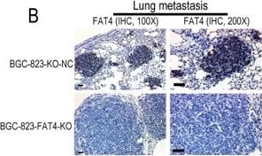 Immunohistochemistry: FAT4 Antibody [FITC] [NBP1-78381F] - H&E & IHC staining of metastatic lung nodules in the nude mice model(A) Representative images (40X, 100X & 400X) of H&E stained lung sections from nude mice injected via the tail vein with BGC-823-FAT4-KO & BGC-823-KO-NC cells. (B) Representative images show IHC staining with anti-FAT4 antibody of lung sections from BGC-823-FAT4-KO & BGC-823-KO-NC group mice. FAT4 is positive staining in the lung metastatic tumor nodules of BGC-823-KO-NC group, whereas it negative expresses in BGC-823-FAT4-KO group. Scale bar, 100 μm. (C) Histogram shows Ki-67 expression & index (%) in lungs of the BGC-823-FAT4-KO & BGC-823-KO-NC group mice. As shown, the BGC-823-FAT4-KO group shows higher Ki-67 index (%) than BGC-823-KO-NC group. Data represent mean ± SD from 3 independent experiments. Scale bar, 100 μm. * denotes P < 0.05 compared to control. Image collected & cropped by CiteAb from the following publication (//www.oncotarget.com/lookup/doi/10.18632/oncotarget.23702), licensed under a CC-BY license. Not internally tested by Novus Biologicals.