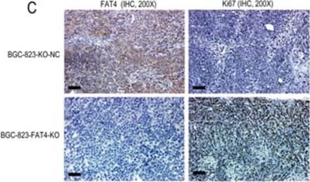 Immunohistochemistry: FAT4 Antibody [FITC] [NBP1-78381F] - Effect of FAT4 knockout on GC tumorigenesis in the nude mice xenograft model(A) Nude mice xenografted (n=5) with BGC-823-FAT4-KO cells (left side) show increased tumor growth (size) than tumors in mice xenografted with control BGC-803-NC cells (right side). (B) BGC-823-FAT4-KO cell derived xenograft tumors show increased tumor volume than control BGC-823-KO-NC cells (*P<0.05). The data points represent mean tumor volume ± SD measured on the indicated days. (C) Representative images show IHC staining of BGC-823-KO-NC & BGC-823-FAT4-KO derived xenograft tumors with antibodies against FAT4 & Ki-67. Scale bar, 100 μm. (D) Histogram plots show percent Ki-67 positive cells in BGC-823-KO-NC & BGC-823-FAT4-KO derived xenograft tumors. As shown, the Ki-67 index is higher in the BGC-823-FAT4-KO derived tumors than BGC-823-KO-NC derived tumors. Data represent mean ± SD from 3 independent experiments. * denotes P < 0.05 compared to control. Image collected & cropped by CiteAb from the following publication (//www.oncotarget.com/lookup/doi/10.18632/oncotarget.23702), licensed under a CC-BY license. Not internally tested by Novus Biologicals.