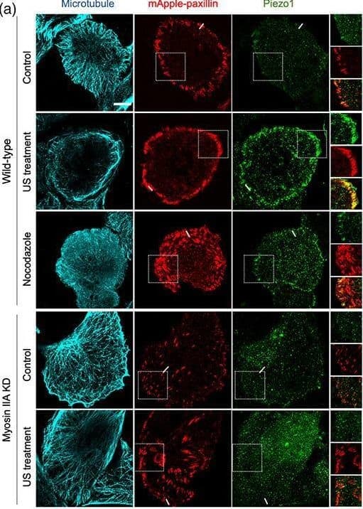 Immune response of macrophages after blocking Piezo1. (A) IF staining of CCR7 and CD206 in the Control, LPS and GsMTx4+LPS groups after 4-day-cultured. M1 macrophages were marked with CCR7 (red), M2 macrophages with CD206 (green), and nuclei with DAPI (blue). (B) Semi-quantitative analysis of CCR7 and CD163 in each group. (C) Flow cytometry analysis of RAW264. 7 cells in the Control, LPS and GsMTx4+LPS groups. Q6 represents M1 types (F4/80+/iNOS+) and Q10 represents M2 types (F4/80+/CD206+). (D) Expressions of Piezo1 and inflammation-related genes (Tnfa and Il1b) in macrophages cultured for 4 days. (E) Western blotting analysis of PIEZO1, IL-1B and TNF-A in RAW264. 7 cultured for 4 days. (F) Intracellular ROS levels of RAW264. 7 cultured for 4 days. (G) Concentration of inflammatory cytokines in macrophage medium detected by ELISA. *P  204 cells. ****p  204 cells. ****p  204 cells. ****p < 0.0001. In all image panels, scale bar: 10 μm Image collected and cropped by CiteAb from the following open publication (//pubmed.ncbi.nlm.nih.gov/34589605), licensed under a CC-BY license. Not internally tested by Novus Biologicals.