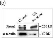 Ultrasound induces Piezo1 expression and localization to peripheral adhesion in MDA‐MB‐231 cancer cells. (a) Fluorescent images showing spatial distribution of microtubule, paxillin, and Piezo1 in the wild‐type (control, ultrasound‐ and nocodazole‐treated) and myosin IIA KD (control and ultrasound‐treated) cells. (b) Corresponding fluorescent intensity plot displaying paxillin and Piezo1 distribution in cells under different experimental condition described in panel a. (c) Western blot measuring the Piezo1 expression level in control and US‐treated cancer cells. (d) Western blot showing myosin IIA expression in control siRNA and myosin IIA KD cancer cells. (e) Western blot showing Piezo1 expression in control siRNA and Piezo1 KD cancer cells. (f) Fluorescent images showing microtubule network in myosin IIA KD cells and bar diagram demonstrating number of intact microtubules with and without US treatment. n = 15 cells. (g) Fluorescent images showing microtubule network and bar diagram showing number of intact microtubules in Piezo1 KD cells with and without US treatment, n = 25 cells. (h) Representative images illustrating microtubule network and Pieoz1 localization in control and US‐treated cells and bar diagram estimating cell population with peripheral Piezo1 in control and US‐treated cells, n > 204 cells. ****p < 0.0001. In all image panels, scale bar: 10 μm Image collected and cropped by CiteAb from the following open publication (//pubmed.ncbi.nlm.nih.gov/34589605), licensed under a CC-BY license. Not internally tested by Novus Biologicals.