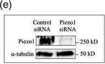 Ultrasound induces Piezo1 expression and localization to peripheral adhesion in MDA‐MB‐231 cancer cells. (a) Fluorescent images showing spatial distribution of microtubule, paxillin, and Piezo1 in the wild‐type (control, ultrasound‐ and nocodazole‐treated) and myosin IIA KD (control and ultrasound‐treated) cells. (b) Corresponding fluorescent intensity plot displaying paxillin and Piezo1 distribution in cells under different experimental condition described in panel a. (c) Western blot measuring the Piezo1 expression level in control and US‐treated cancer cells. (d) Western blot showing myosin IIA expression in control siRNA and myosin IIA KD cancer cells. (e) Western blot showing Piezo1 expression in control siRNA and Piezo1 KD cancer cells. (f) Fluorescent images showing microtubule network in myosin IIA KD cells and bar diagram demonstrating number of intact microtubules with and without US treatment. n = 15 cells. (g) Fluorescent images showing microtubule network and bar diagram showing number of intact microtubules in Piezo1 KD cells with and without US treatment, n = 25 cells. (h) Representative images illustrating microtubule network and Pieoz1 localization in control and US‐treated cells and bar diagram estimating cell population with peripheral Piezo1 in control and US‐treated cells, n > 204 cells. ****p < 0.0001. In all image panels, scale bar: 10 μm Image collected and cropped by CiteAb from the following open publication (//pubmed.ncbi.nlm.nih.gov/34589605), licensed under a CC-BY license. Not internally tested by Novus Biologicals.