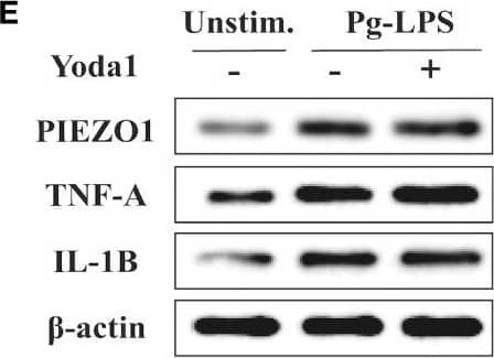 Immune response of macrophages after activating Piezo1. (A) IF staining of CCR7 and CD206 in the Control, LPS and Yoda1+LPS groups after 4-day-cultured. M1 macrophages were marked with CCR7 (red), M2 macrophages with CD206 (green), and nuclei with DAPI (blue). (B) Semi-quantitative analysis of CCR7 and CD206. (C) Flow cytometry analysis of RAW264. 7 cells in the Control, LPS and Yoda1+LPS groups. Q6 represents M1 types (F4/80+/iNOS+) and Q10 represents M2 types (F4/80+/CD206+). (D)Piezo1, Tnfa and Il1b genes expressions in macrophages cultured for 4 days. (E) Western blotting analysis of PIEZO1, TNF-A and IL-1B in RAW264. 7 cultured for 4 days. (F) Intracellular ROS levels of RAW264. 7 cultured for 4 days. (G) Concentration of inflammatory cytokines in macrophages medium detected by ELISA. *P < 0. 05; **P < 0. 01; ***P < 0. 001. Image collected and cropped by CiteAb from the following open publication (//pubmed.ncbi.nlm.nih.gov/37261355), licensed under a CC-BY license. Not internally tested by Novus Biologicals.