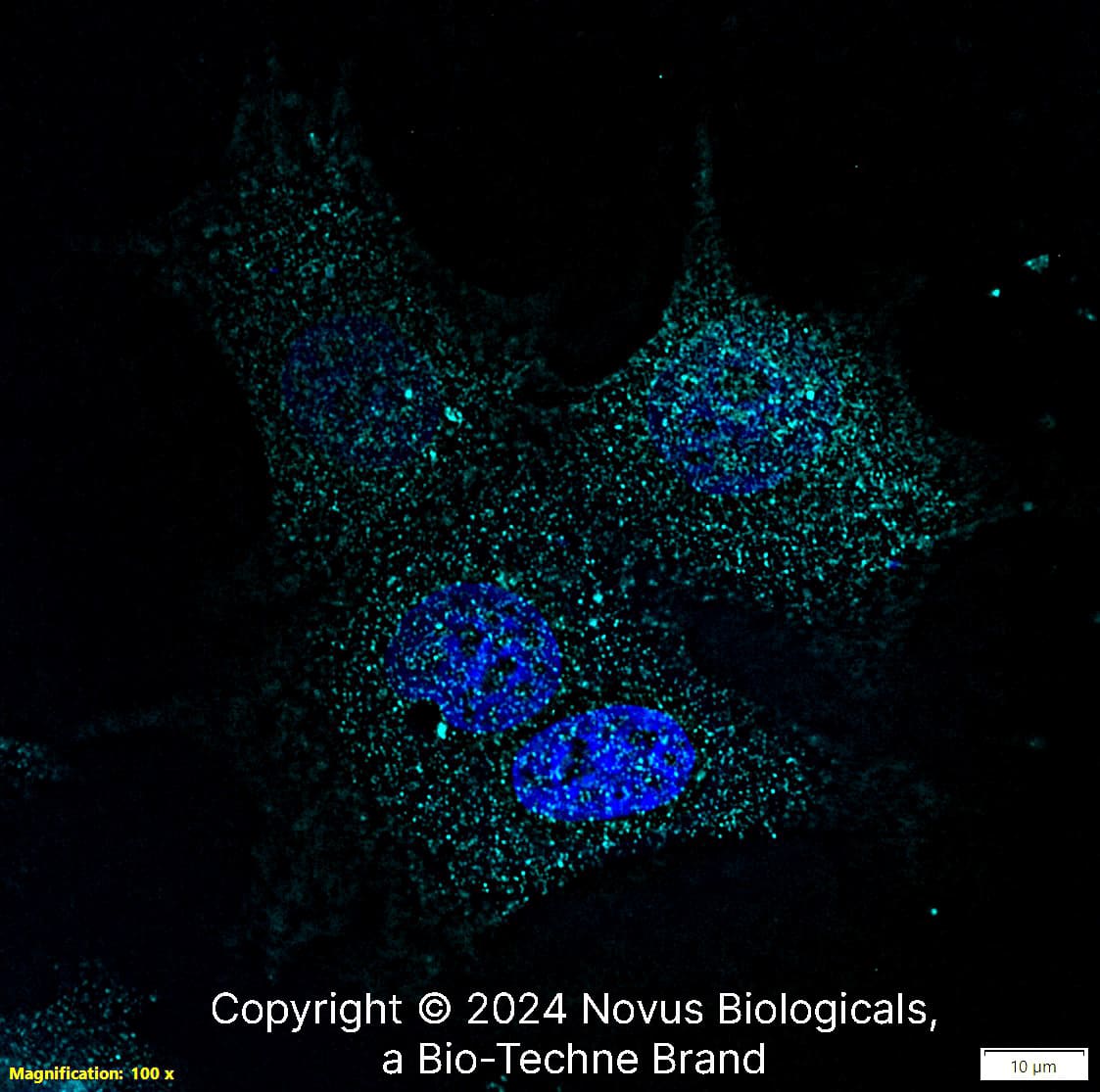 PIEZO1 was detected in immersion fixed MCF7 human breast cancer cell line using Rabbit anti-PIEZO1 Affinity Purified Polyclonal Antibody conjugated to DyLight 650 (Catalog # NBP1-78446C) (light blue) at 10 µg/mL overnight at 4C. Cells were stained counterstained with DAPI (blue). Cells were imaged using a 100X objective and digitally deconvolved.