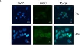 Immunohistochemistry: PIEZO1 Antibody - BSA Free [NBP1-78537] - Piezo1 expression & cell function of human nucleus pulposus cells under mechanical stress. A NP cells received various mechanical stress treatment. Cell viability was measured by MTT assay. B Gene expression of Piezo1 was measured by real-time PCR. C, D Western blot analysis of Piezo1’s protein level. Total  beta -actin served as loading controls. E, F Immunofluorescence staining analysis of Piezo1 expression. Relative fluorescent levels of Piezo1 were measured by Image J software. G Concentrations of pro-inflammatory cytokines TNF-alpha , IL-1 beta , & IL-6 in supernatants were measured by ELISA. H Mitochondrial membrane potential was measured by JC-1 probe & flow cytometer. I OCR of cells were measured by Seahorse XFe96 Extracellular Flux Analyzer at basal conditions & with serial administration of oligomycin, FCCP & rotenone. J–L Gene & protein expressions of P53 & P16. Total  beta -actin served as loading controls. *p < 0.05. All experiments were repeated at least three times Image collected & cropped by CiteAb from the following publication (//pubmed.ncbi.nlm.nih.gov/35606793), licensed under a CC-BY license. Not internally tested by Novus Biologicals.