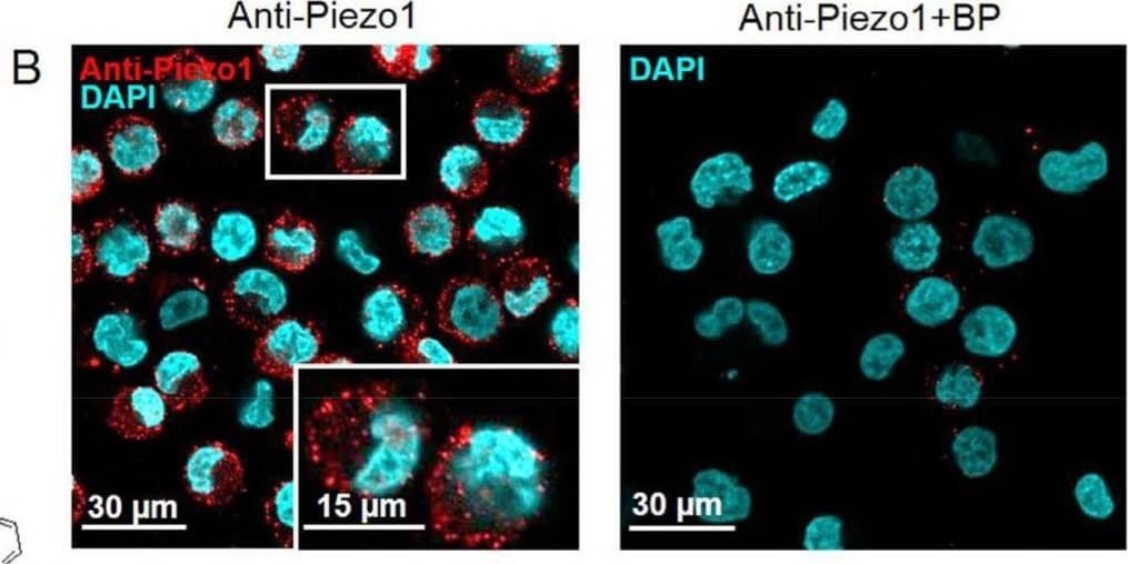 Piezo1 is expressed in human leukemia K562 cells. (A) RT-PCR analysis revealed the presence of hPIEZO1 mRNA. Cropped gel with enhanced contrast is shown. (B) Immunofluorescent staining with specific antibodies detected Piezo1 proteins (Anti-Piezo1, red channel) in the cells. Cell nuclei were counterstained with DAPI (blue channel). Cells in white frame are shown in 2× zoom. No staining of the cells was observed after pre-incubation of the anti-Piezo antibody with the specific corresponding blocking peptide (Anti-Piezo+BP). (C) The single-channel activity of Piezo1 induced by Yoda1 (10 uM in the pipette solution) recorded in the representative cell-attached experiment at different membrane potentials. Here and elsewhere, the index shows a number of active channels (C—closed state (zero current), O—channel openings). Holding membrane potential is indicated near current traces. (D) The mean I-V relationship corresponds to a single-channel conductance of 19.2 +/- 1.2 pS (n = 9). Image collected and cropped by CiteAb from the following open publication (//pubmed.ncbi.nlm.nih.gov/34360605), licensed under a CC-BY license. Not internally tested by Novus Biologicals.