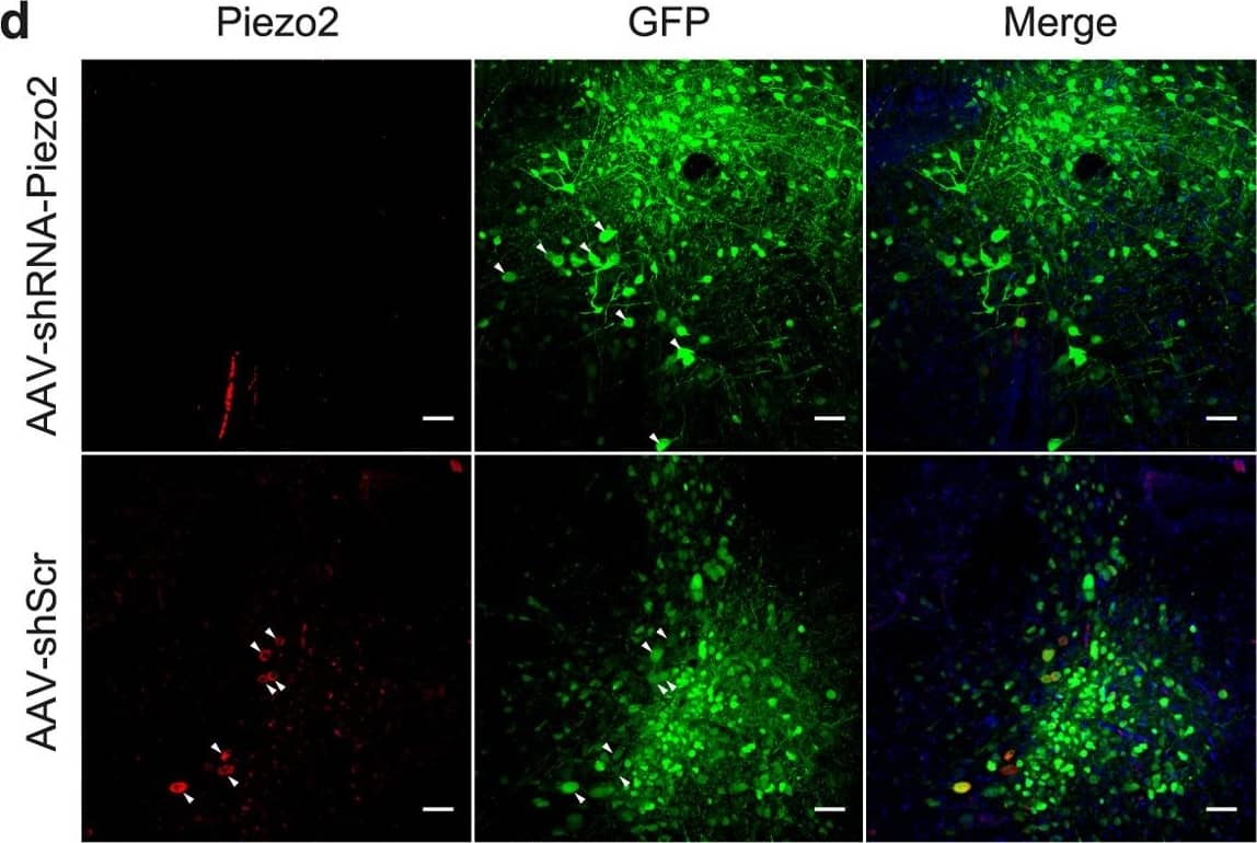 Photomicrographs of immunostaining for osteocalcin and osteopontin in (A) Group I, (B) Group II (C) Group III at 6 weeks.The pictures are arranged by staining technique (columns) and the investigated treatment (rows). Areas that stained positive for osteocalcin and osteopontin are indicated by red arrowheads. NB, new bone; OS, osteoid; FM, fatty marrow. Image collected and cropped by CiteAb from the following open publication (//peerj.com/articles/3513), licensed under a CC-BY license. Not internally tested by Novus Biologicals.