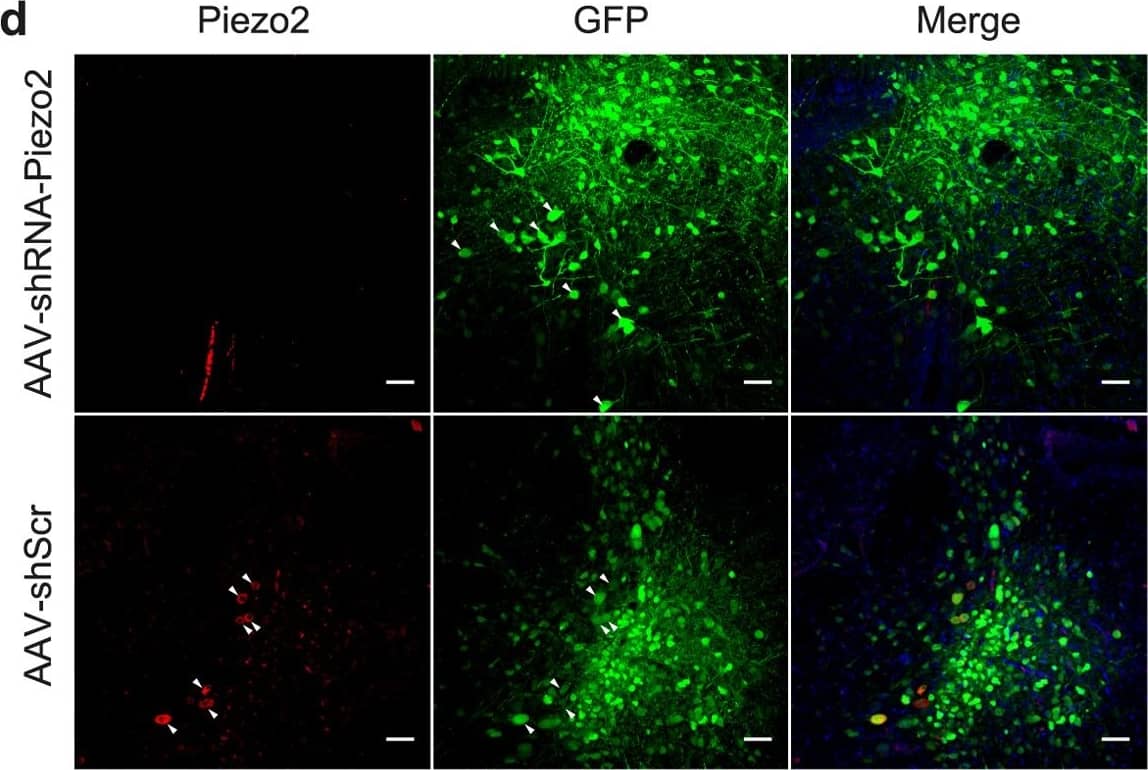 Immunocytochemistry/ Immunofluorescence: PIEZO2 Antibody - BSA Free [NBP1-78624] - Suppression of MA in MTN neurons from adult C57BL/6J mice by silencing Piezo2.(a) Schematic representation of the unilateral adeno-associated viral (AAV) injection site targeting MTN neurons. (b) Fluorescence images showing the expression of GFP-tagged MTN neurons in brain slices following AAV delivery. (b’) Higher magnification of the boxed area in (b). (c) The AAV-Piezo2-sh-1 construct. (d) Brainstem coronal sections of C57BL/6J mice infected with the AVV-shRNA against Piezo2 (middle) & the scrambled AVV (lower), showing MTN neurons immunolabeled for Piezo2 (left, red) or GFP (middle, green), & the merged image of both, with the nuclei stained with DAPI (blue). Arrowheads indicate representative MTN neurons. Scale bar 50 μm. (e) Traces of MA currents evoked by mechanical indentation in MTN neurons infected with AAV-Piezo2-sh-1 or with a scrambled AVV (f). (g) Trace from a MTN neuron infected with AAV-Piezo2-sh-1 that responded with RA mechanical activated currents ( tau  = 6.2 ms). The inset shows a higher magnification of the current trace corresponding to a 7 μm displacement. The black upper trace shows the 250 ms mechanical stimulus steps in 1 μm increments applied every 10 s, the breaks in the trace corresponding to equivalent breaks in the recording. (h) Histogram summarizing the mean amplitude of the RA currents in MTN neurons from WT mice (n = 69) & those infected with AAV-Piezo2-sh-1 (n = 20) or AAV-shScr (n = 8). The data are expressed as the means ± s.e.m.: *p < 0.05 (Student’s t-test). Image collected & cropped by CiteAb from the following publication (//www.nature.com/articles/srep25923), licensed under a CC-BY license. Not internally tested by Novus Biologicals.