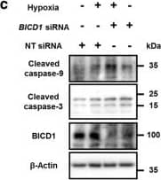Western Blot: BICD1 Antibody [NBP1-78735] - Role of BICD1 in UCB-MSCs survival under hypoxia. a, b The UCB-MSCs were transfected with BICD1 or NT siRNA for 24 h prior to hypoxia treatment. a Cells were exposed to various durations of hypoxia (0–72 h). Cell viability of UCB-MSCs was measured by WST-1 cell viability assay. n = 8. b Cells were incubated in normoxia or hypoxia conditions for 72 h. Representative images of experimental groups at 0, 24, 48, & 72 h of normoxia or hypoxia incubation are presented. Red-marked cells in representative images indicate PI-positive cells. n = 4. Scale bars are 50 μm (Magnification, × 200). cBICD1 or NT siRNA-transfected cells were incubated in hypoxia for 24 h. Cleaved caspase-9, cleaved caspase-3, &  beta -Actin protein expressions were detected by western blot analysis. n = 4. d Cells were transfected with BICD1 or NT siRNA for 24 h prior to hypoxia treatment for 48 h. The percentages of apoptotic cells were analyzed by Annexin V/PI analysis, measured by flowcytometer. Annexin V-positive cells were considered as apoptotic cells. n = 4. Quantitative data are presented as a mean ± S.E.M. All blot images are representative. *p < 0.05 vs. normoxia control with NT siRNA transfection, #p < 0.05 vs. hypoxia with NT siRNA transfection. e The UCB-MSCs were transfected with pcDNA3.1/BICD1-cEGFP vector, pcDNA3.1/cEGFP vector, HIF1A siRNA or NT siRNA for 24 h prior to hypoxia treatment for 72 h. Cell viability data are presented as a mean ± S.E.M. n = 5. *p < 0.05 vs. normoxia control with pcDNA3.1/cEGFP vector & NT siRNA cotransfection, #p < 0.05 vs. hypoxia control with pcDNA3.1/cEGFP vector & NT siRNA cotransfection, @p < 0.05 vs. hypoxia control with pcDNA3.1/BICD1-cEGFP vector & NT siRNA cotransfection Image collected & cropped by CiteAb from the following publication (//pubmed.ncbi.nlm.nih.gov/30464225), licensed under a CC-BY license. Not internally tested by Novus Biologicals.