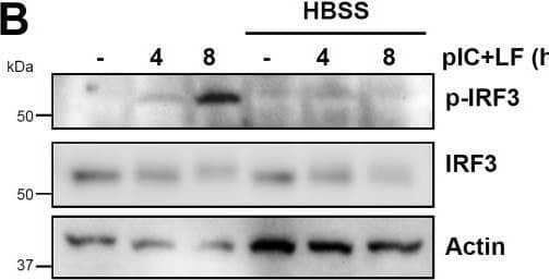 Autophagic degradation inhibits the transcriptional activity of IRF3.A, MDA-MB-453 cells were treated with Hank's balanced salt solution (HBSS) for the indicated times when the protein levels of IRF3 were analyzed by immunoblot. B and C, MDA-MB-453 cells were transfected with polyI:C (pIC+LF) in the absence or the presence of HBSS for the indicated times, when the protein levels of pIRF3 and IRF3 (B) and IFIT3 (C) were analyzed by immunoblot. D–F, MDA-MB-453 (D, E) or RAW264.7 (F) cells were transfected with polyI:C (pIC+LF) in the absence or the presence of HBSS for 8 h, when IFIT3 (D), IFNB1 (E), and Ifit1 (F) mRNA levels were analyzed by qRT-PCR. G, HT1080 cells were transfected with polyI:C (pIC+LF) in the absence or the presence of HBSS and phosphorylated (on Ser172), and total TBK1 was analyzed by immunoblot after 4 h. H, HT1080 cells were transfected with polyI:C (pIC+LF) in the absence or the presence of HBSS and phosphorylated (on Thr180/Tyr182) and total p38 MAPK was analyzed by immunoblot after 4 h. I, U4C (Wt) and IRF3-overexpressing U4C (IRF3hi) cells were transfected with polyI:C (pIC+LF) in the absence or the presence of HBSS, and IFIT3 and IRF3 were analyzed by immunoblot at the indicated times posttransfection. ∗ indicates p < 0.05. Image collected and cropped by CiteAb from the following open publication (//linkinghub.elsevier.com/retrieve/pii/S0021925821010772), licensed under a CC-BY license. Not internally tested by Novus Biologicals.