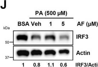 Autophagic degradation of IRF3 by auranofin inhibits palmitic-acid-induced apoptotic cell death in human hepatocytes.A, Huh7 cells were treated with palmitic acid (PA) or vehicle (bovine serum albumin, BSA) for 24 h, when the caspase-3 activity was measured. B and C, Huh7 cells were treated with PA, and apoptotic cell death was analyzed by immunoblot of cleaved PARP (B) or bright field microscopy (C). D and E, Huh7 cells were treated with PA, and the caspase activity (D), and cleaved PARP (E) were analyzed at the indicated times post-treatment. F and G, Huh7 cells were pretreated with auranofin (AF) at the indicated concentrations and treated with PA. Caspase activity (F) and cleaved PARP (G) were measured 16 h posttreatment. H, Huh7 cells were treated with AF at the indicated concentrations for 8 h when cell viability was assessed by trypan blue exclusion assay. I, Huh7 cells were transfected with nontargeting (NT) or IRF3-specific siRNA, and the cells were analyzed for caspase-3 activity upon PA treatment for 16 h. The lower panel indicates the knockdown levels of IRF3 protein. J and K, Huh7 cells were pretreated with AF at the indicated concentrations and treated with PA. IRF3 (J) and p62 (K) were analyzed 16 h posttreatment. L, Huh7 cells were treated with AF, as indicated, and the LC3 levels were analyzed by immunoblot. Veh, Vehicle (DMSO), ∗ indicates p < 0.05, NS, nonsignificant, scale bar, 100 μm. Image collected and cropped by CiteAb from the following open publication (//linkinghub.elsevier.com/retrieve/pii/S0021925821010772), licensed under a CC-BY license. Not internally tested by Novus Biologicals.