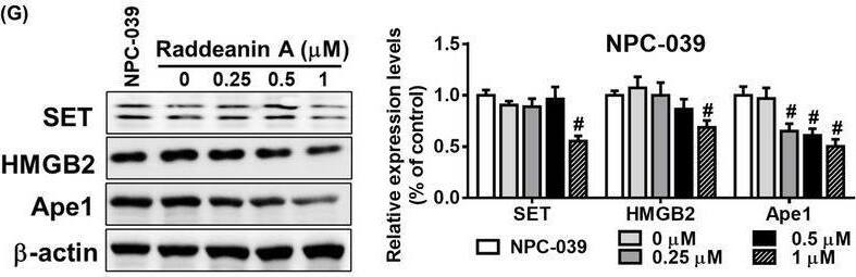 Raddeanin A‐treated NK cells enhance apoptosis in NPC‐039 cells. (A, B) Mitochondrial membrane potential assay and (C, D) annexin V/PI stain assay of NPC‐039 cells were measured after Raddeanin A treatment by Muse Cell Analyser. Quantitative data were analysed by Muse Cell Software V1.4.0.0. (E) Fas protein levels of Raddeanin A‐induced apoptosis. NPC‐039 cells were cocultured with KHYG‐1 cells at an effector: Target ratio of 6:1 And then treated with Raddeanin A for 24 h. (F) NPC‐039 cells were treated with Raddeanin A for 24 h. Cell viability was assessed using WST‐8 assays. (G, H) Protein levels of Raddeanin A‐induced apoptosis. NPC‐039 cells were cocultured with KHYG‐1 cells at an effector: Target ratio of 6:1 And then treated with Raddeanin A for 24 h. ImageJ was used for protein quantification; the levels of all proteins were normalized to that of  beta ‐Actin. Data were presented as the mean +/- standard deviation (n = 3) of three independent experiments. *p < 0.05 compare with control; # p < 0.05 compare with cotreatment control. Image collected and cropped by CiteAb from the following open publication (//pubmed.ncbi.nlm.nih.gov/39175122), licensed under a CC-BY license. Not internally tested by Novus Biologicals.