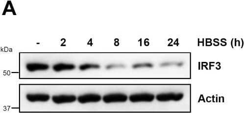 Autophagic degradation inhibits the transcriptional activity of IRF3.A, MDA-MB-453 cells were treated with Hank's balanced salt solution (HBSS) for the indicated times when the protein levels of IRF3 were analyzed by immunoblot. B and C, MDA-MB-453 cells were transfected with polyI:C (pIC+LF) in the absence or the presence of HBSS for the indicated times, when the protein levels of pIRF3 and IRF3 (B) and IFIT3 (C) were analyzed by immunoblot. D–F, MDA-MB-453 (D, E) or RAW264.7 (F) cells were transfected with polyI:C (pIC+LF) in the absence or the presence of HBSS for 8 h, when IFIT3 (D), IFNB1 (E), and Ifit1 (F) mRNA levels were analyzed by qRT-PCR. G, HT1080 cells were transfected with polyI:C (pIC+LF) in the absence or the presence of HBSS and phosphorylated (on Ser172), and total TBK1 was analyzed by immunoblot after 4 h. H, HT1080 cells were transfected with polyI:C (pIC+LF) in the absence or the presence of HBSS and phosphorylated (on Thr180/Tyr182) and total p38 MAPK was analyzed by immunoblot after 4 h. I, U4C (Wt) and IRF3-overexpressing U4C (IRF3hi) cells were transfected with polyI:C (pIC+LF) in the absence or the presence of HBSS, and IFIT3 and IRF3 were analyzed by immunoblot at the indicated times posttransfection. ∗ indicates p < 0.05. Image collected and cropped by CiteAb from the following open publication (//linkinghub.elsevier.com/retrieve/pii/S0021925821010772), licensed under a CC-BY license. Not internally tested by Novus Biologicals.