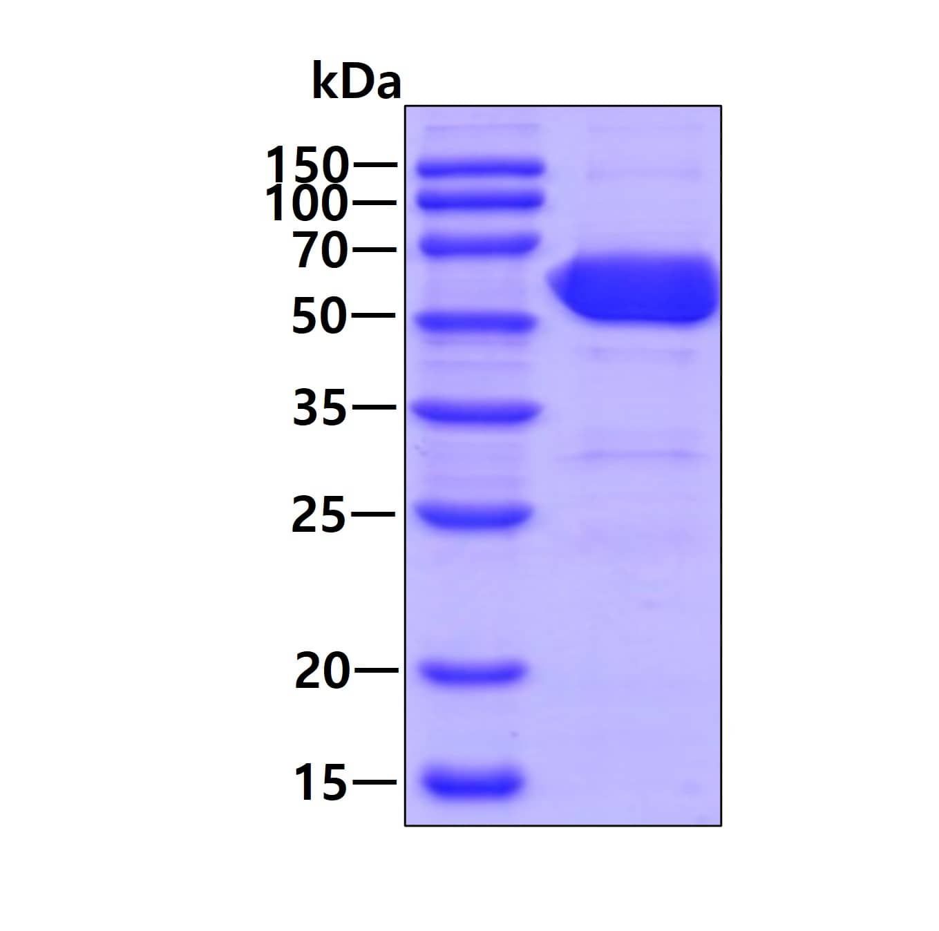 SDS-PAGE Recombinant Human Importin alpha 2/KPNA2 His Protein