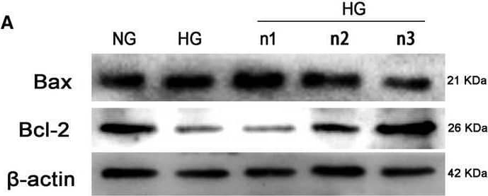 Apoptosis level reduced after nicorandil treatment in high glucose‐induced H9c2 cardiomyocyte. A: Western blot analysis of bax and bcl‐2 in high glucose‐induced H9c2 cardiomyocyte after nicorandil treatment with different concentrations for 24 h. B: Western bolt analysis of cleaved caspase‐3 in high glucose‐induced H9c2 cardiomyocyte after nicorandil treatment. HG (33.3 mmol/L), NG (5.5 mmol/L), n1: nicorandil (10 umol); n2: nicorandil (50 umol); n3: nicorandil (100 umol). #P < 0.05 compared with NG; *P < 0.05 compared with HG, Data are means +/- SD Image collected and cropped by CiteAb from the following open publication (//pubmed.ncbi.nlm.nih.gov/31131539), licensed under a CC-BY license. Not internally tested by Novus Biologicals.