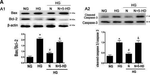 Nicorandil protects H9C2 cells from apoptosis through PI3K/AKT pathway. A: Western blot analysis of Bax/Bcl‐2 and cleaved caspase‐3 in high glucose‐induced H9c2 cardiomyocyte after nicorandil treatment or both nicorandil treatment and 5‐HD which is a inhibitor of nicorandil. B: TUNEL assay of apoptosis rate of high glucose‐induced H9c2 cardiomyocyte after nicorandil treatment or both nicorandil treatment and nicorandil inhibitor（5‐HD, 500 umol) (scale bar: 20 um). I:NG, II:HG, III:HG + N, IV:HG + N+5‐HD; C: Western blot analysis of phosphorylation level of PI3K, AKT, eNOS and mTOR in high glucose‐induced H9c2 cardiomyocyte after nicorandil treatment or both nicorandil treatment and nicorandil inhibitor（5‐HD). N: Nicorandil (100 umol); NG: normal glucose (5.5 mmol/L); HG: high glucose (25 mmol/L). *P < 0.05 compared with NG; #P < 0.05 compared with HG; & P < 0.05 compared with HG + N, Data are means +/- SD Image collected and cropped by CiteAb from the following open publication (//pubmed.ncbi.nlm.nih.gov/31131539), licensed under a CC-BY license. Not internally tested by Novus Biologicals.