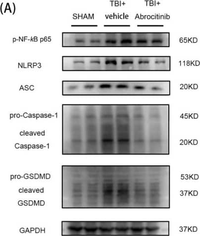 Effects of abrocitinib on NF kappa B-related inflammation and pyroptosis pathways. On the 1st day after TBI, NF kappa B-related inflammation and the activation of pyroptosis pathways were dramatically increased. After abrocitinib treatment, the indicators of NF kappa B-related inflammation and pyroptosis pathways were significantly decreased, as can be seen from the WB (n = 5–9 one-way ANOVA with Tukey’s post-hoc test) and GSDMD IHC staining (A–C) (n = 6 Kruskal-Wallis test). From the ELISA results, the changes in inflammatory cytokines (IL-1 beta  and IL-18) after brain injury and the effects of abrocitinib were precisely revealed (D,E) (n = 5–6 one-way ANOVA with Tukey’s post-hoc test). All data are shown as mean +/- SD. * p < 0.05, ** p < 0.01, *** p < 0.001, **** p < 0.0001. Image collected and cropped by CiteAb from the following open publication (//pubmed.ncbi.nlm.nih.gov/36429017), licensed under a CC-BY license. Not internally tested by Novus Biologicals.