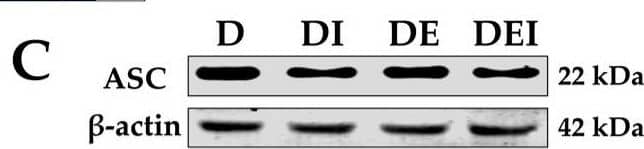 The measurement of pyroptosis-related markers after intervention in the mice. (A) IF staining (×200) (left) and the IOD of NLRP3 in GAS of db/db mice (n = 6). The protein expression levels of (B) NLRP3; (C) ASC; (D) Caspase-1 and (E) GSDMD were detected by western blot in the GAS of db/db mice (n = 6). Serum inflammatory markers (F) IL-1 beta  and (G) IL-18 by ELISA (n = 8). (#) Significant difference compared with D group; (&) significant difference compared with DI group; ($) significant difference compared with DE group (p < 0.05). Image collected and cropped by CiteAb from the following open publication (//www.mdpi.com/1420-3049/29/3/712), licensed under a CC-BY license. Not internally tested by Novus Biologicals.