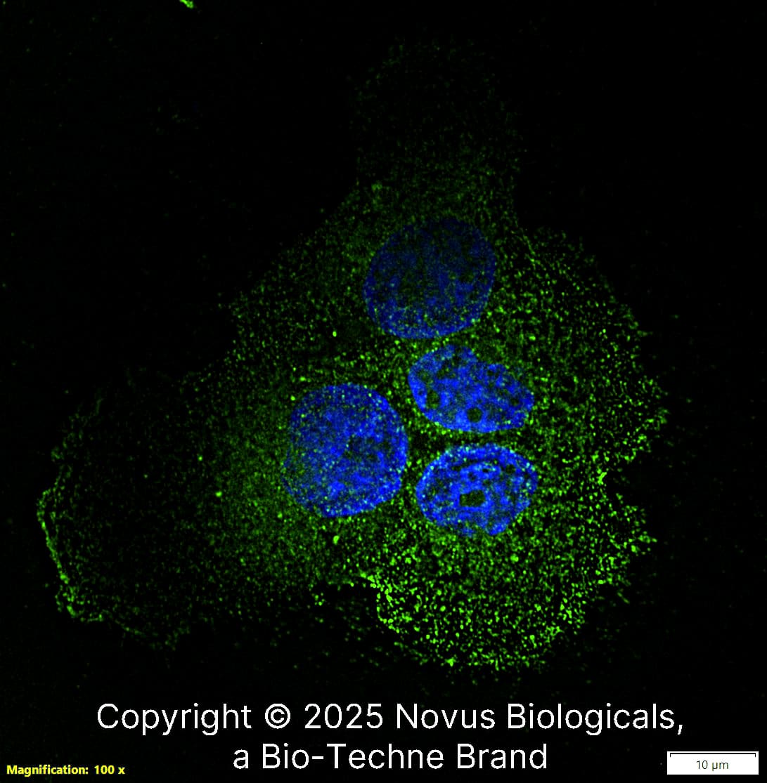 Desmoglein-3 Antibody (5H10) was detected in immersion fixed A431 human skin carcinoma cell line using Mouse anti-Desmoglein-3 Antibody (5H10) Protein G Purified Monoclonal Antibody conjugated to Alexa Fluor® 488 (Catalog # NBP1-78984AF488) (green) at 10 µg/mL overnight at 4C. Cells were counterstained with DAPI (blue). Cells were imaged using a 100X objective and digitally deconvolved.