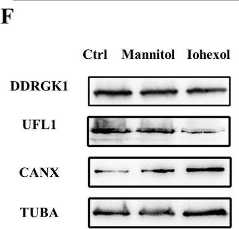 In vitro CI-AKI model shows reduced ER-phagy.HK-2 cells were incubated in DMEM/F12 containing Iohexol (150 mg I/ml) for 6 h. A CCK-8 assay of Iohexol-treated HK-2 cells, together with the isosmotic control group, mannitol-treated HK-2 cells. B, C Diagrammatic representation of the mCherry cleavage from ER assay. Briefly, degradation of ER resulted in the lysosomal cleavage of the mCherry tag from RAMP4, which caused a smaller, mCherry-only product to be resolved by immunoblot analysis. D Diagrammatic representation of ER-phagy tandem reporter assay. eGFP is quenched in lysosomal-induced low pH situations, causing GFP+/mCherry+ to GFP−/mCherry+ during ER-phagy. E The representative image of ER-phagy tandem reporter assay by confocal microscope. Scale bar: 5 μm. White arrows: GFP−/mCherry+ puncta. F–I The immunoblot analysis and quantification of DDRGK1, UFL1, CANX in cell lysates. J–L The immunoblot analysis and quantification of GRP78 and CHOP in cell lysates. M, N The immunoblot analysis and quantification of BAX in cell lysates. Data are presented as the mean +/- SEM (n = 3). *p < 0.05, **p < 0.01 and ***p < 0.001. Image collected and cropped by CiteAb from the following open publication (//pubmed.ncbi.nlm.nih.gov/38233375), licensed under a CC-BY license. Not internally tested by Novus Biologicals.