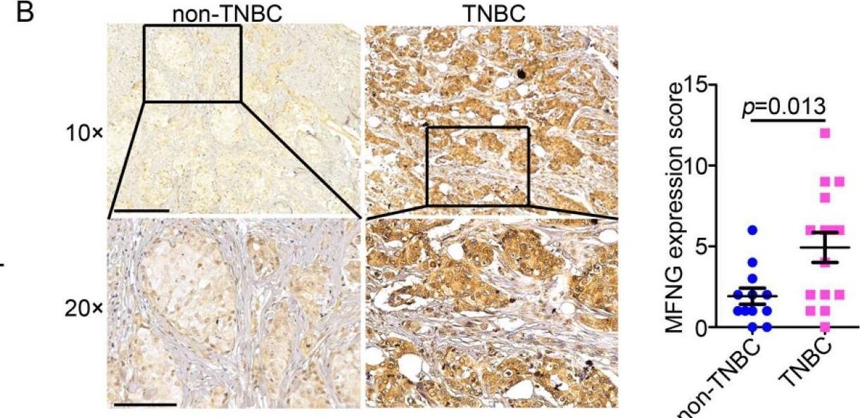 miR205-5p reduced the MFNG mRNA level by directly binding to its 3′ UTR region and inhibited the malignancy of TNBC cells. (A) The predicted binding sites of miR205-5p in the 3′-UTR of MFNG were performed using bioinformatics. (B,C) Overexpression of miR205-5p mimic in TNBC cells reduced the mRNA and protein expression levels of MFNG, NC was short for negative control and GAPDH was loaded as an internal control. (D) Ectopic expression of miR205-5p reduced the luciferase activity of wild-type 3′-UTR of MFNG in MDA-MB-231cells. Data were analyzed using a Student’s t-test. All * p  −0.4319) expression groups. We analyzed the overall survival of breast cancers (D), non-TNBC (E), and TNBC (F) samples by using the Kaplan–Meier method, breast cancer (MFNG low, n = 358; MFNG high, n = 121; p = 0.5557), non-TNBC (MFNG low, n = 292; MFNG high, n = 99; p = 0.8409), and TNBC (MFNG low, n = 68; MFNG high, n = 23; p < 0.001). Survival curves were plotted by the Kaplan–Meier method and analyzed by the log-rank test. Statistical analyses were analyzed using a Student’s t-test. Image collected and cropped by CiteAb from the following open publication (//pubmed.ncbi.nlm.nih.gov/35804829), licensed under a CC-BY license. Not internally tested by Novus Biologicals.